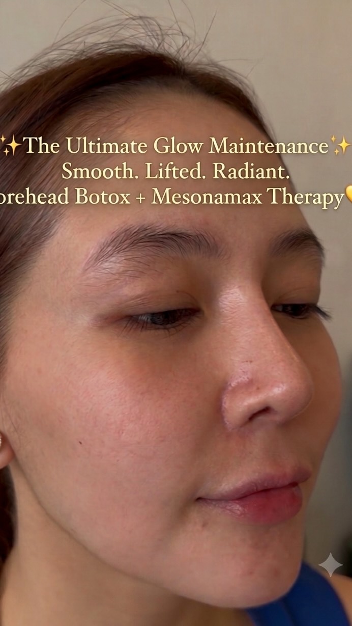 ✨ Maintenance is the real secret to timeless beauty. ✨, A heartfelt thank you to our beautiful loyal client for trusting GLUTA LOUNGE MARIKINA with her aesthetic journey. 💛, Today, she came in for her 