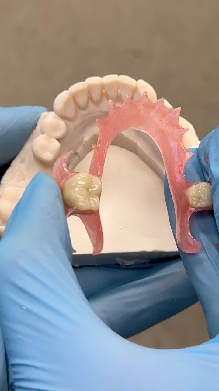 Flexi Stress Test! Case from Dr. Colleen Chambers in Massachusetts ...