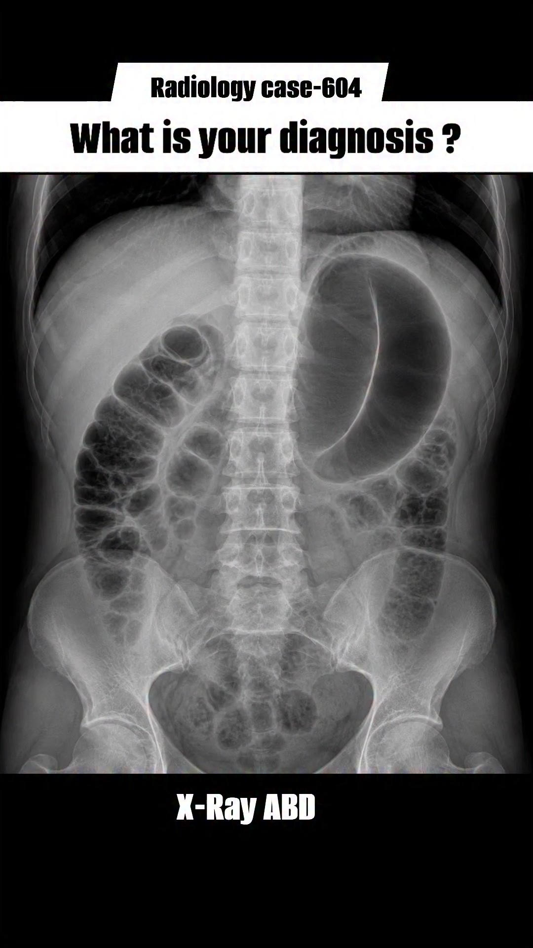 Diagnosis #radiology #medical #radiologist #abdominal #anatomy