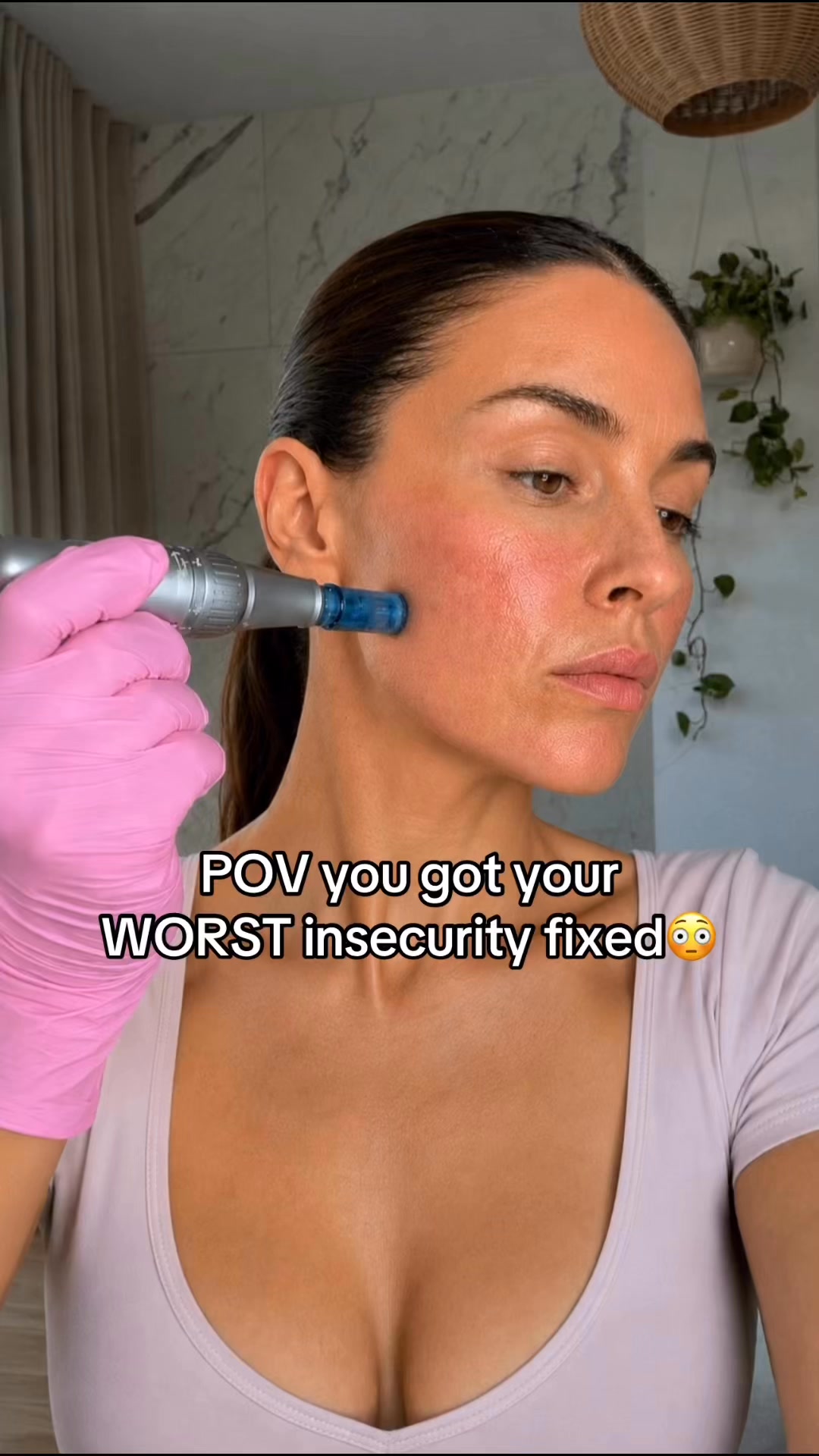 The thing nobody warns you about a Botox consultation is what they're actually selling you: a previous version of yourself. 
