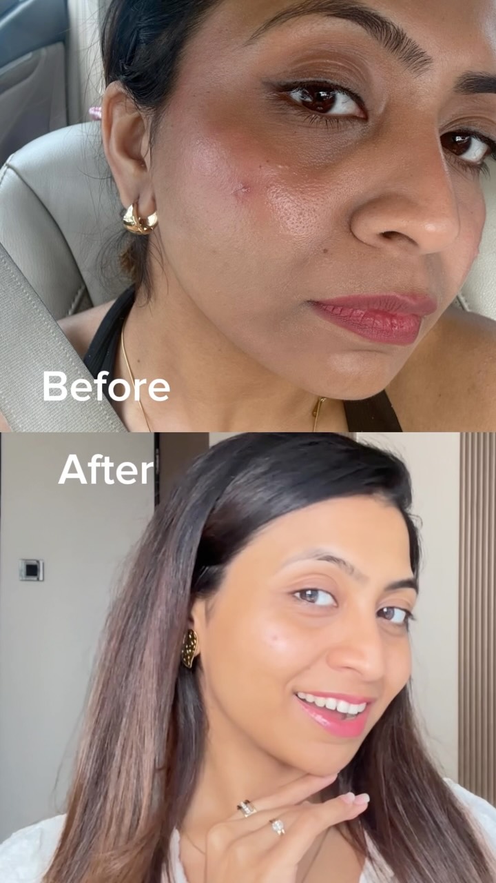 Those results 🤌🏻, Serum for pigmented skin , vitamin c skincare, brightening serum, fade dark spots, reduce hyperpigmentation, glowing skin routine, glass skin tips, niacinamide benefits, glutathione 