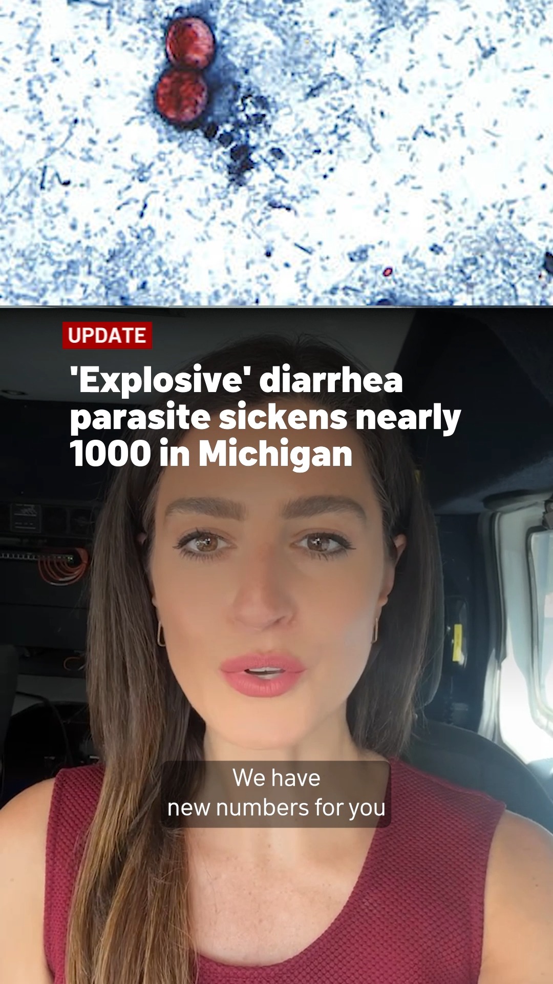 Nearly 1,000 people (992) have been sickened in Michigan by Cyclospora, a parasite that causes severe, sometimes “explosive” diarrhea. , Illinois has reported 141 cases, making it one of the states 