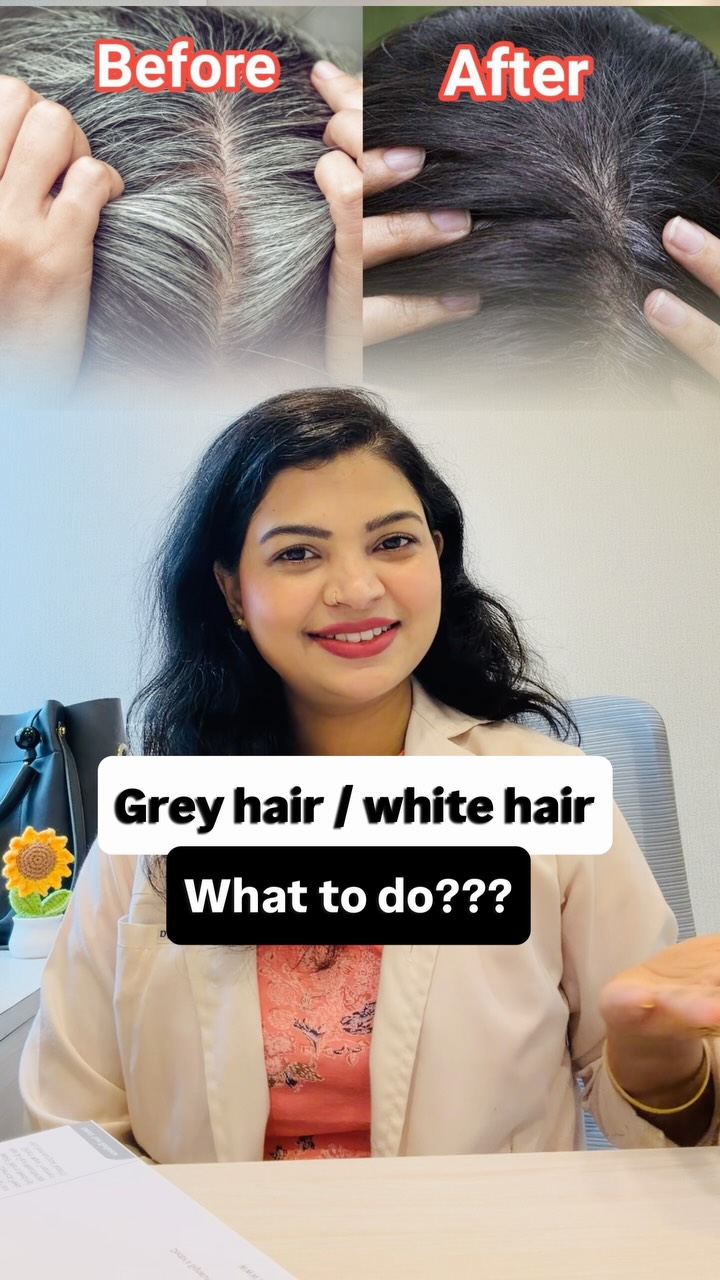 can glutathione reverse grey hair You hair?! 🤯 GHK-Cu Hair Growth Spray Volume:600mg – 5 vial lab pack (Save 5%) Bfriday