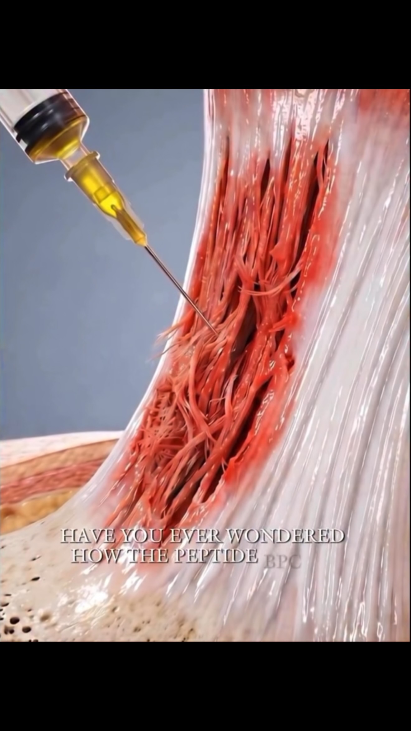 Platelet-rich plasma (PRP) has been around for years—but BP-157 is generating attention because of its potential to support the body’s natural healing response., Research suggests BP-157 may help 