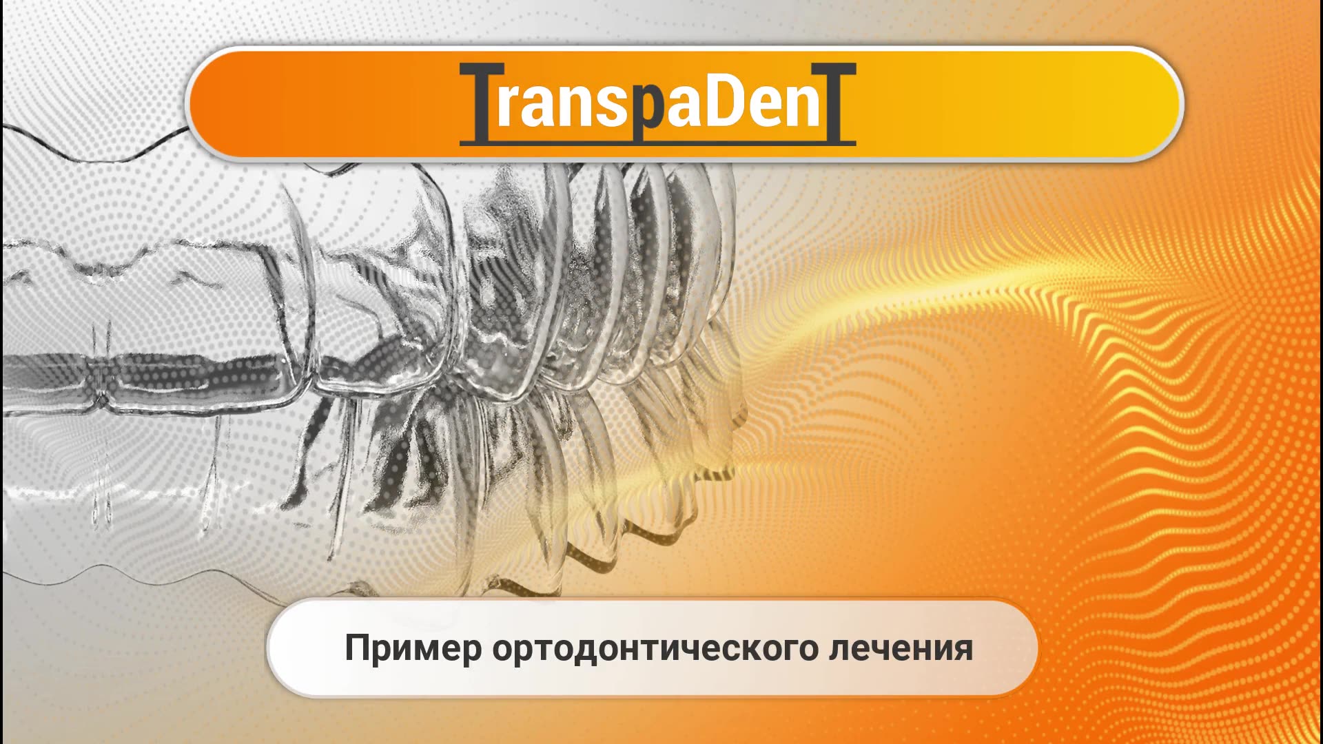 TranspaDent - Home