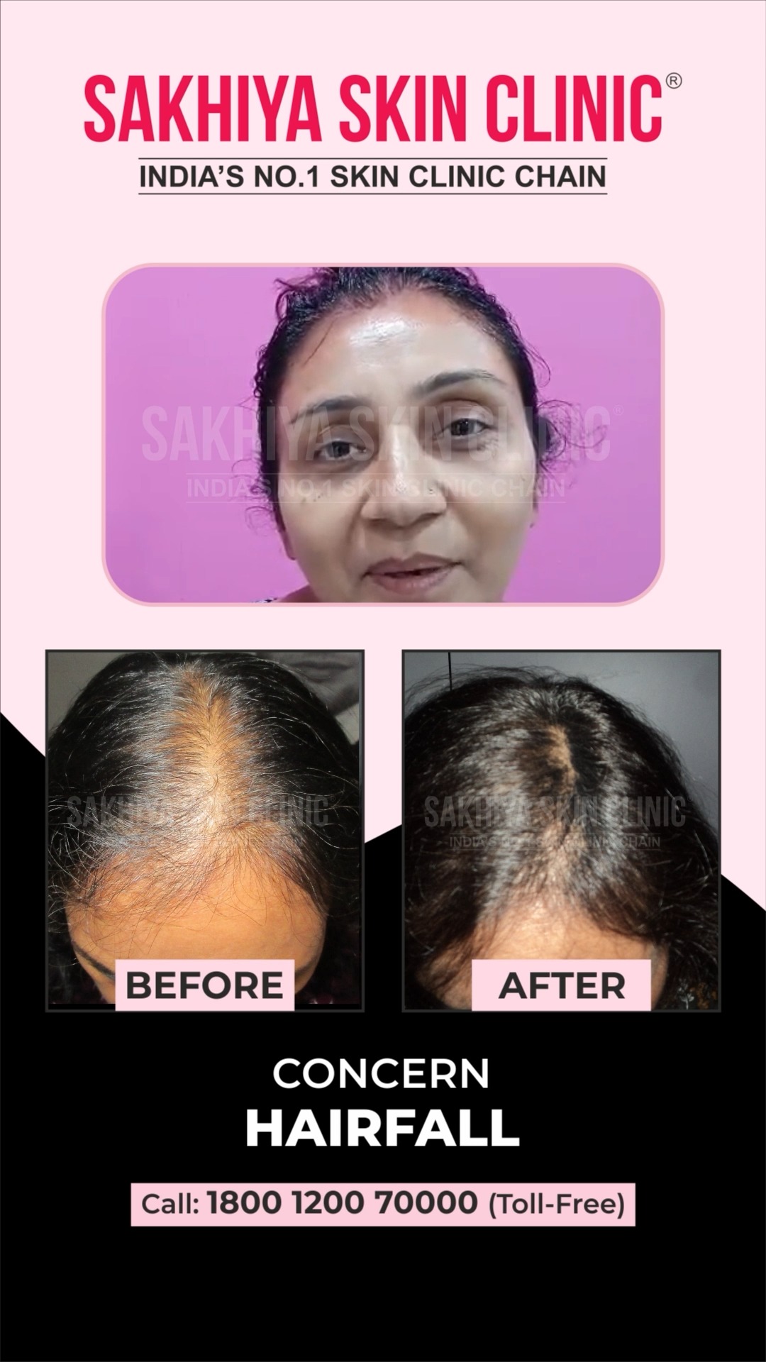 glutathione treatment in kottayam Advanced Solutions for Skin & Hair Problems Vitamin B12 spray for Package:750 mg Multipack (30 pack + 2 bonus) Glutathione face wash for pigmentation