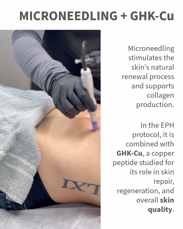 microneedling ghk-cu study EPH Esthetic For Men on Reels filter:Collection:Campus Essentials