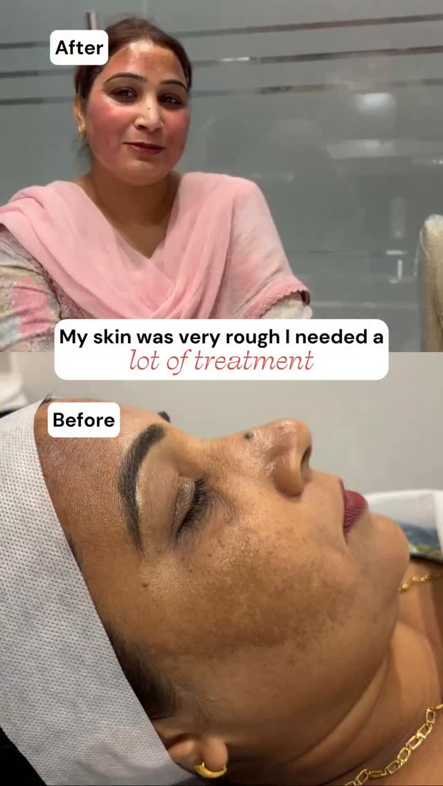 Gleuhr was my last hope and I am glad and grateful that it worked !, https://clinic.gleuhr.com | Dt Gagan Sidhu