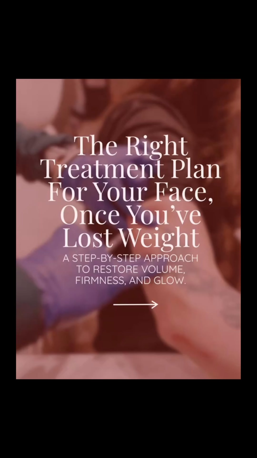 ✨ You lost the weight… now let’s reveal the results. ✨, GLP-1 medications can be life-changing—but after significant weight loss, you may notice loose skin, volume loss, muscle loss, or areas that 