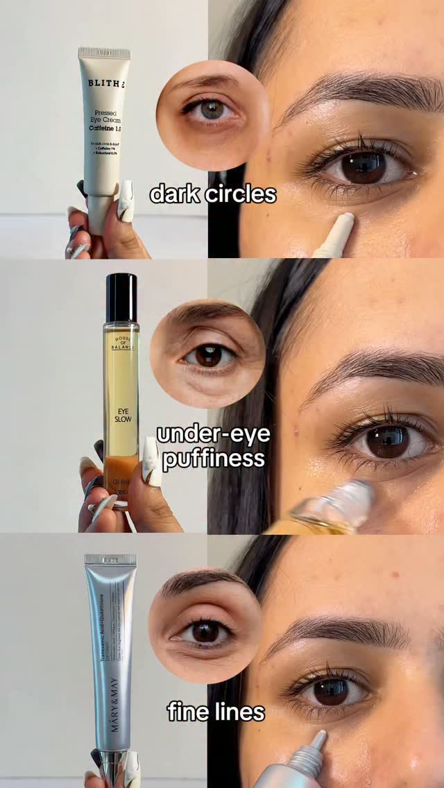 glutathione for under eye dark circles Your under-eye skin tells you what to look 👀, ☕ → caffeine, 💧 Puffiness → soothing + de-puffing care, 〰️ Fine lines → tranexamic acid + glutathione, Are you dealing with any of these magnesium sulfate for preeclampsia