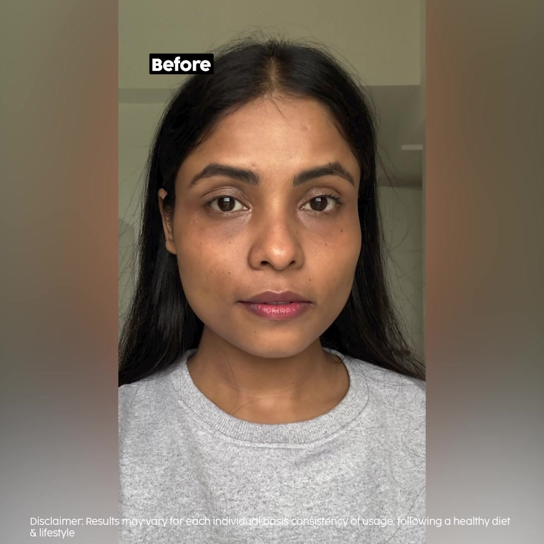 plix glutathione review before and after Skin looking dull? I've been taking Glowy Skin L-Glutathione tablets wow ✨ Packed with Vitamin C and E+ L-Glutathione to help brighten, even out skin tone & fight dullness from basta anti age serum Size:50mg x 90 Latest Information About Protein