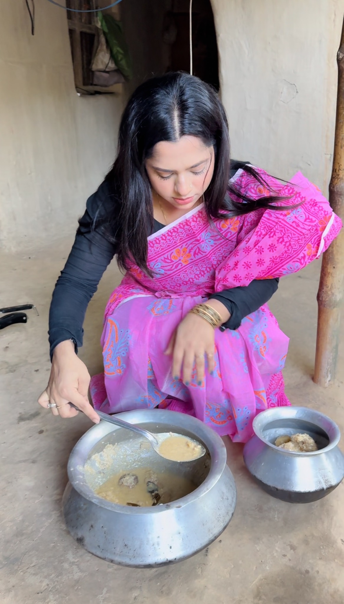 ঠোঁট সার্জারি করলাম।শখ পূরন করতে গিয়ে শিক্ষা হয়ে গেছে আমার।😭 | ঠোঁট ...