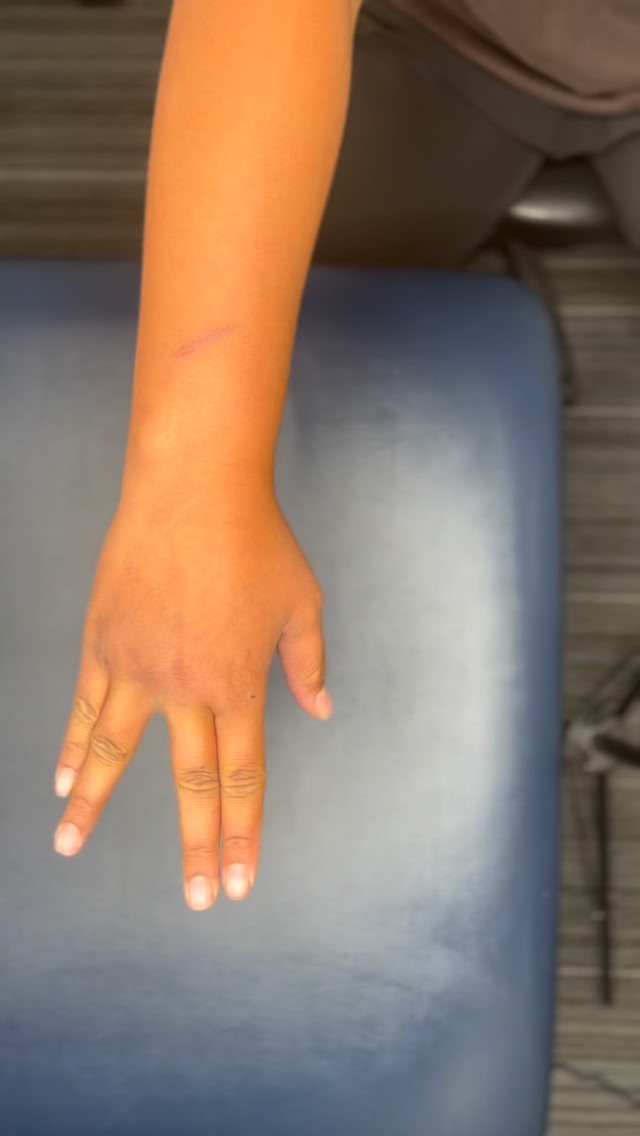 How to strap a hand: Split webbing This can also be used to help ...
