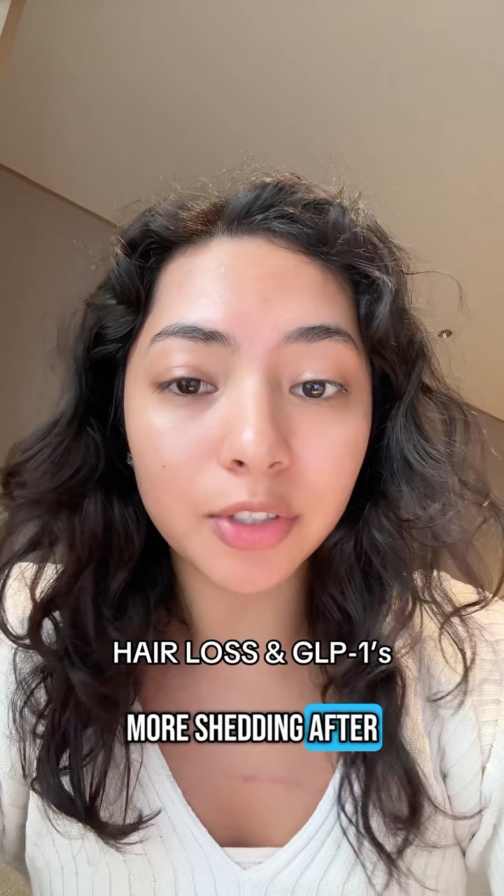 Does GLP-1 medication cause hair loss in PCOS patients?