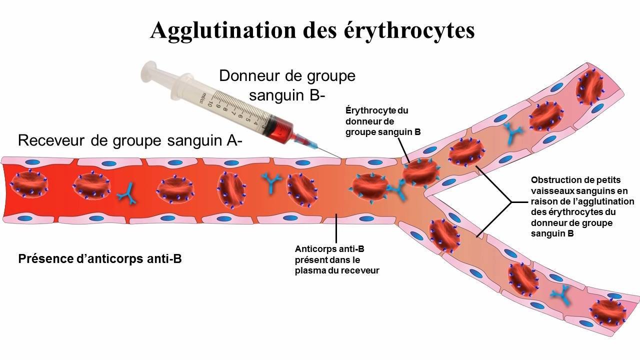 Biologie Simplifiée - Groupes sanguins du système ABO et facteur Rhésus
