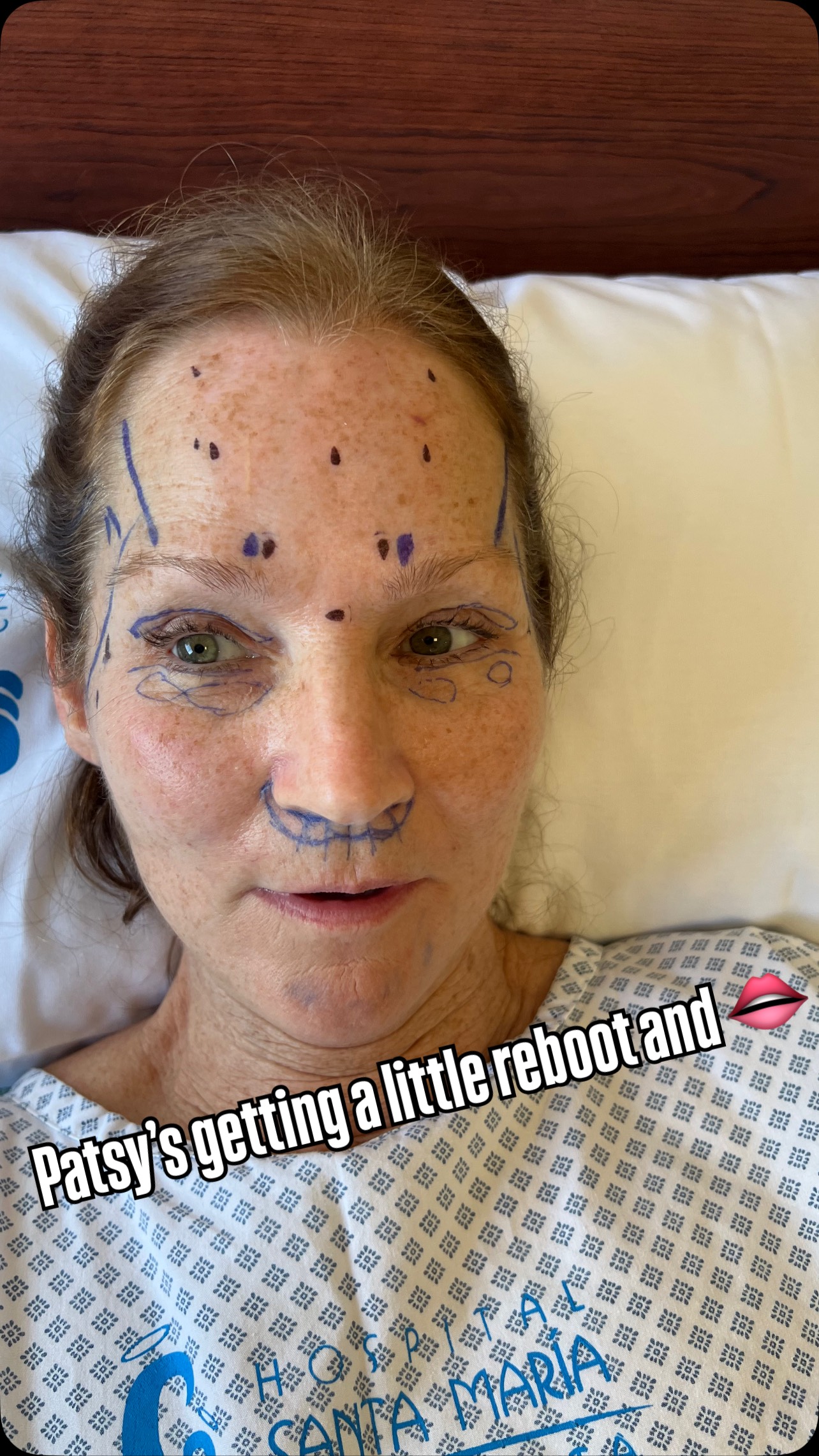 The big news is Patsy is getting a little reboot on her facelift she ...