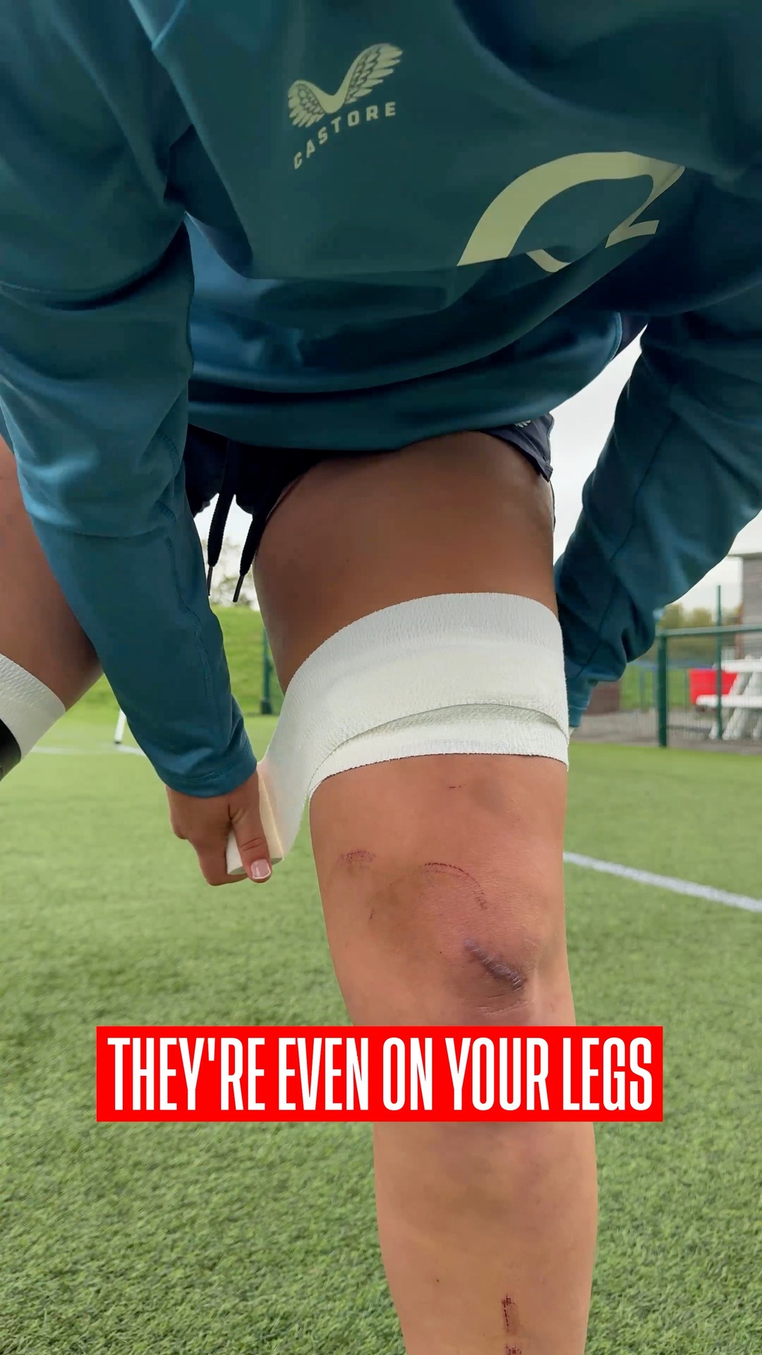 Ever wondered why some rugby players tape their legs like this? 🤔 O2 # ...
