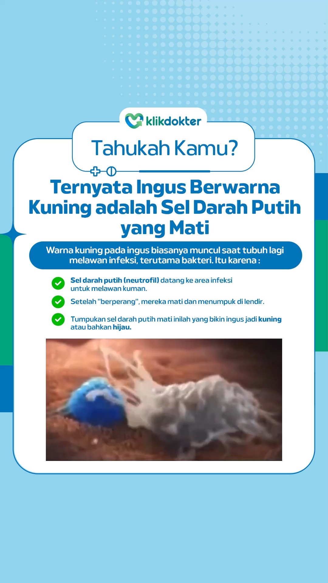 Warna kuning pada ingus ternyata berasal dari sel darah putih ...