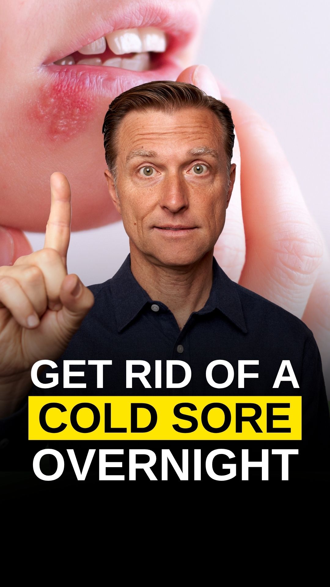 does l-carnitine cause cold sores NOW Foods, Sports, L-Carnitine, Triple Strength, Citrus, 16 fl oz (473 ml) Carnitine: Genetic Variants Affecting Mitochondrial