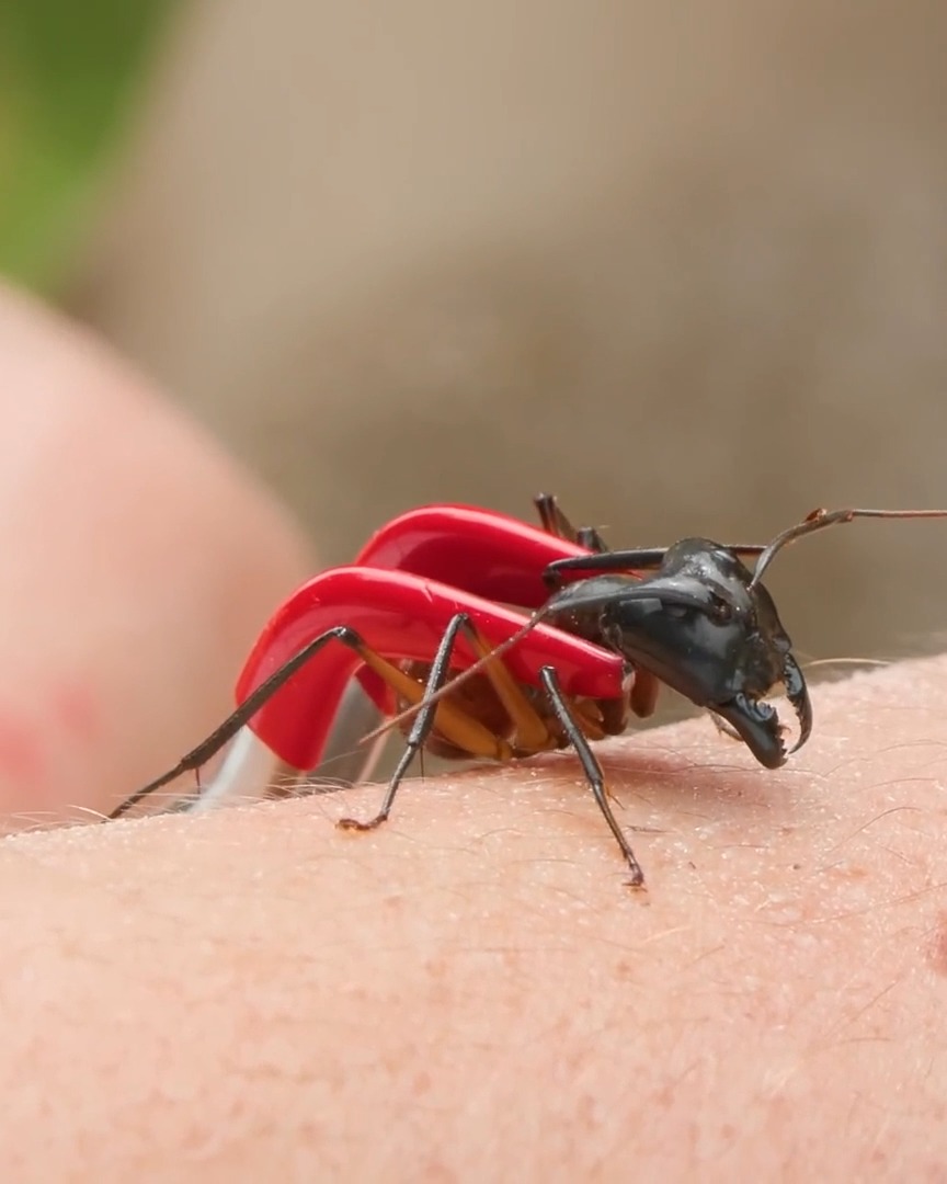 Mark Vins - Bitten by the BIGGEST Ant in the World! | Facebook