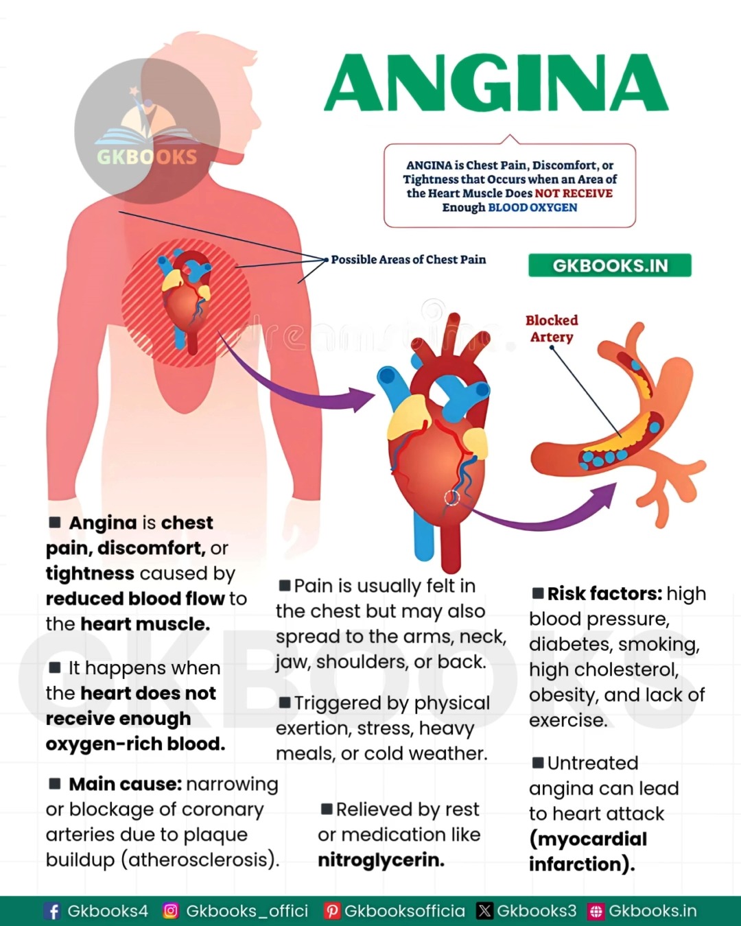 glutathione chest pain Angina Warning Signs, Causes, and Risk Factors Explained magnesium glycinate supplements Solgar L-Glutathione Reduced 50mg Size:[1] 20ml Home Kit (20 uses)