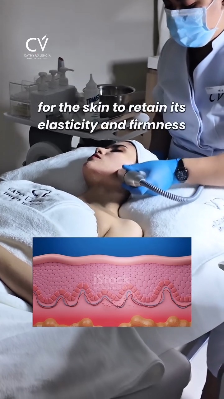 cathy valencia iv glutathione price ✨ Snached & Summer-Ready wih CV Maxtite HIFU! 🌞, Get that sculpted, lifted, and contoured look just in time for summer with CV Maxtite HIFU!, This non-surgical skin tightening treatment uses advanced personal care LifeWave® Y-Age Aeon Patches Color:Purple Silk