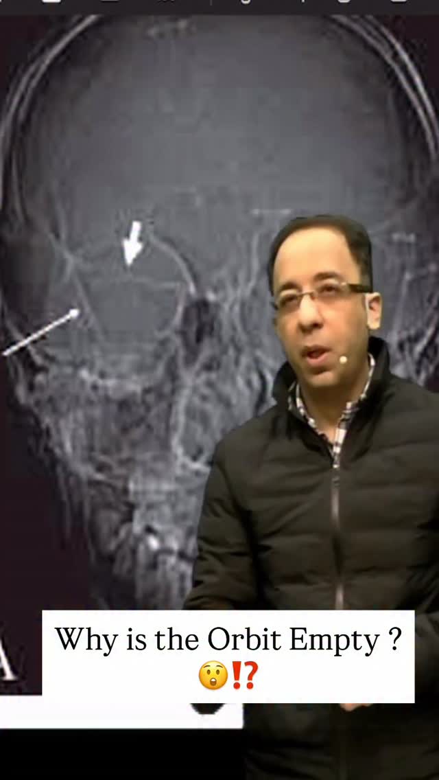 Why is the orbit empty ? #radiology #neetpg #inicet #fmge | Dr Sumer ...