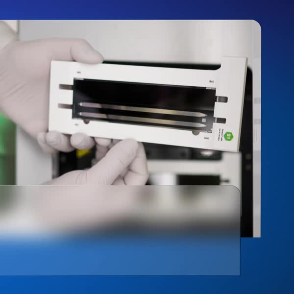Optimal tacrolimus levels are an important factor in the survival of a transplanted organ. Dr. Jessica Wright explains how Mayo Clinic Laboratories' 3A5Q test helps determine initial tacrolimus doses 