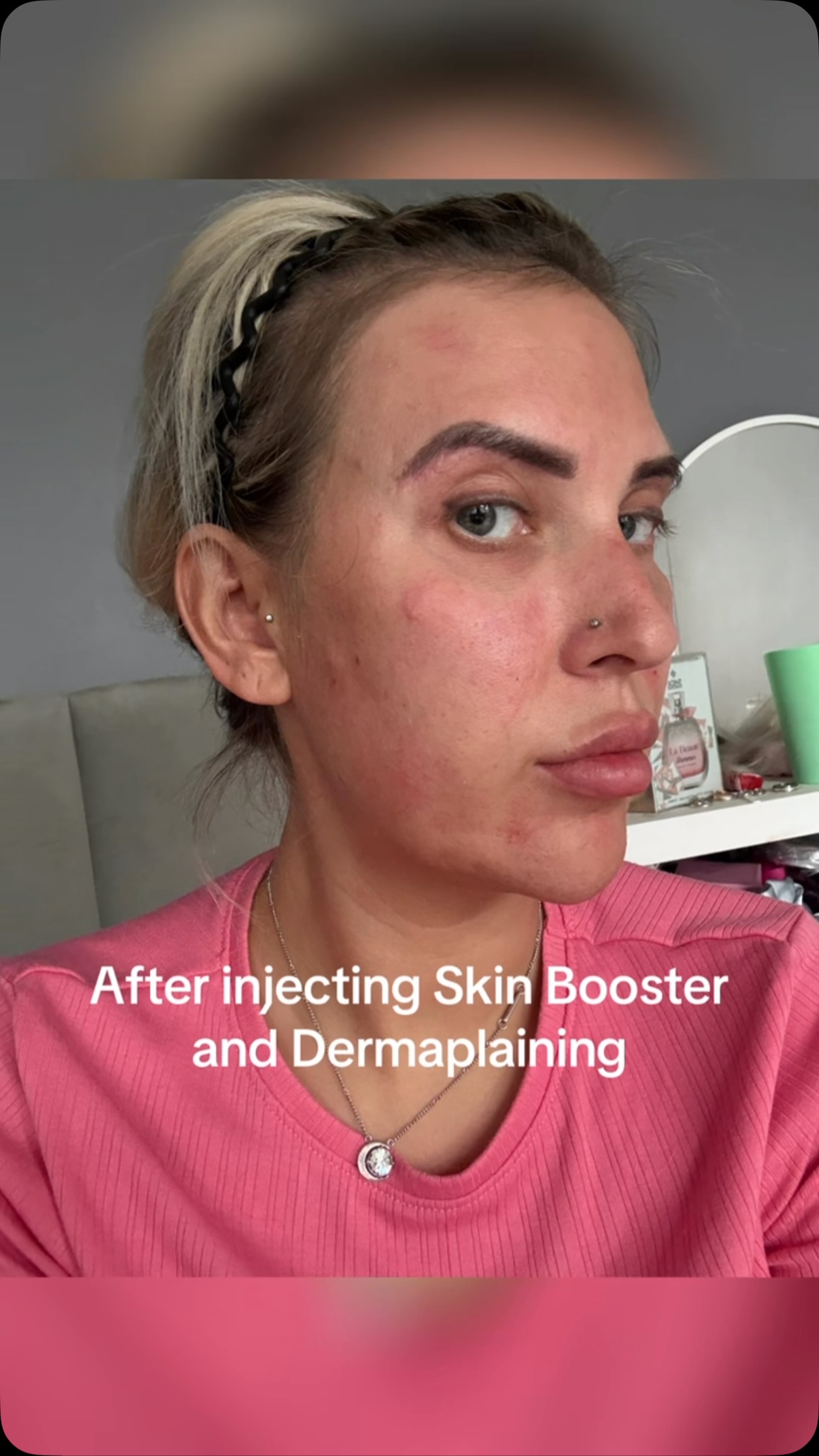 ✨ REGENERATE. RESTORE. REBUILD. ✨, Ready to transform your skin? , 💙 Experience the power of Cu Restore GHK-Cu Peptide Serum, now enhanced with microneedling for even better results! 🌟, 💉 This 