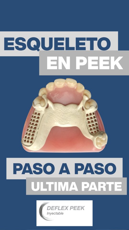 Deflex | Lanús