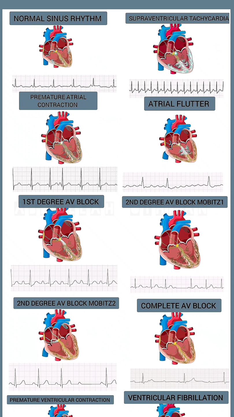 In-Depth Visual Guide to Cardiac Arrhythmias🫀📊 @abdullah_89othman ...