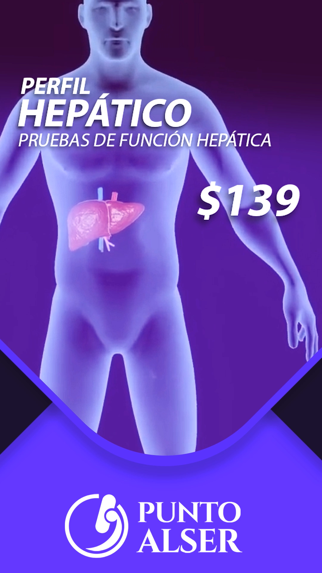 Punto Alser | Monterrey