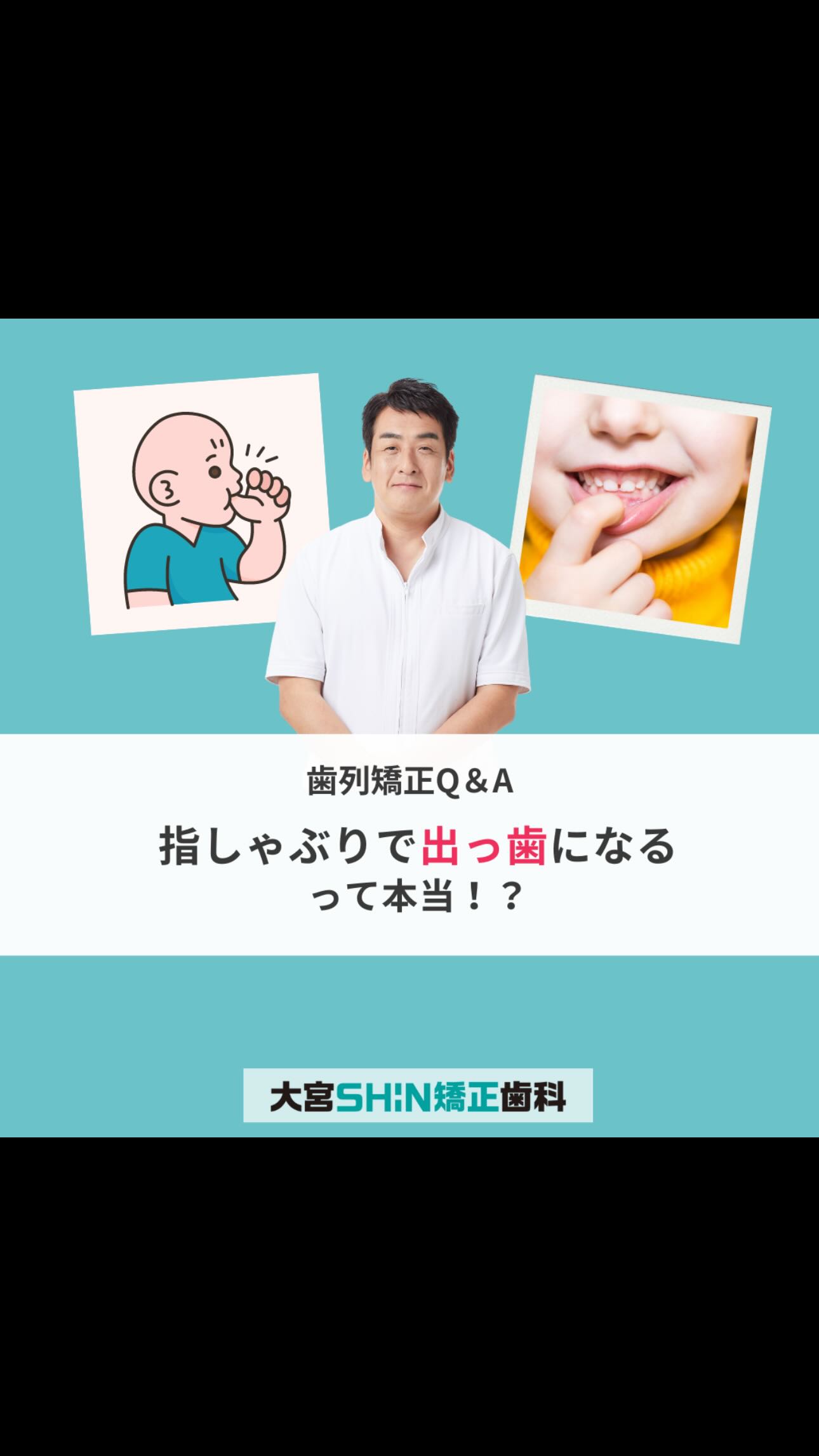 指しゃぶり】3歳すぎたらやめましょう? @omiya_shin_orthodontics 