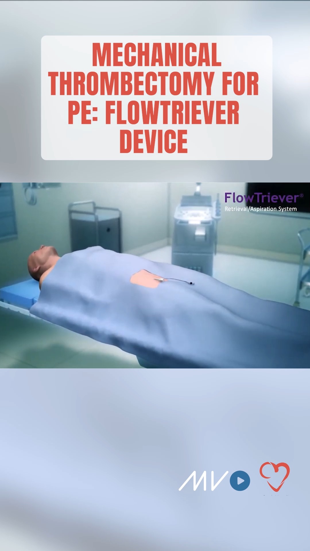 How does FlowTriever clear clots in PE? Minimizing blood loss while ...