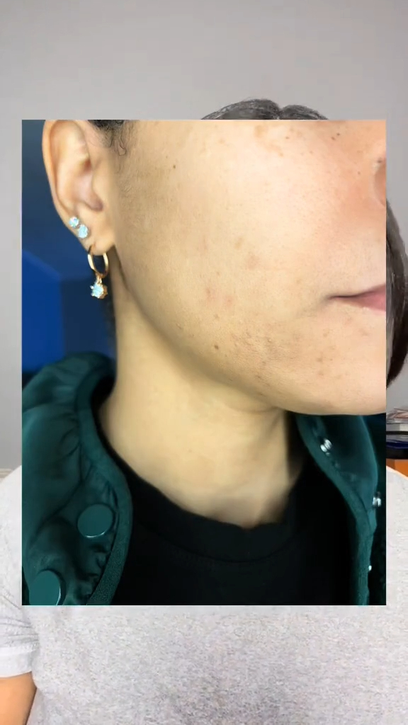 avon glutathione capsule review How to target dark spots and discolored areas on the face: , 🧡Cleanse face and pat dry, 🧡Apply the Anew Vitamin C Targeted Skin Brightener to problem areas, 🧡Follow up with remaining skincare, IV Therapy Menu | Capsule Count:30 Capsules super antioxidant
