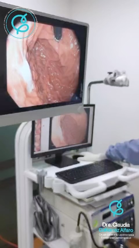 Endoscopia zapopan