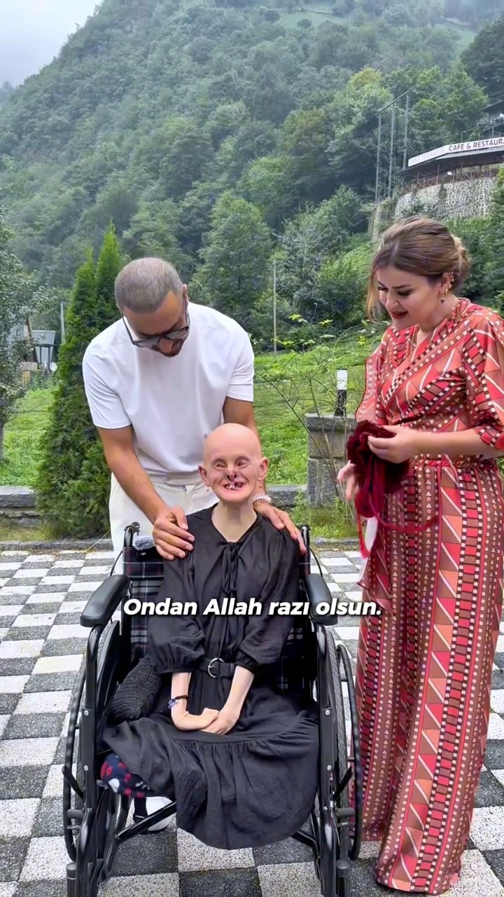Ah Rabia’m ah…“27 yıldır saçlarım yok” diyor.“Hep saçlarım olsun ...
