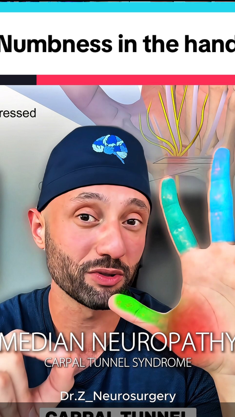 Identifying the nerve entrapment causing numbness in the hand. Things ...
