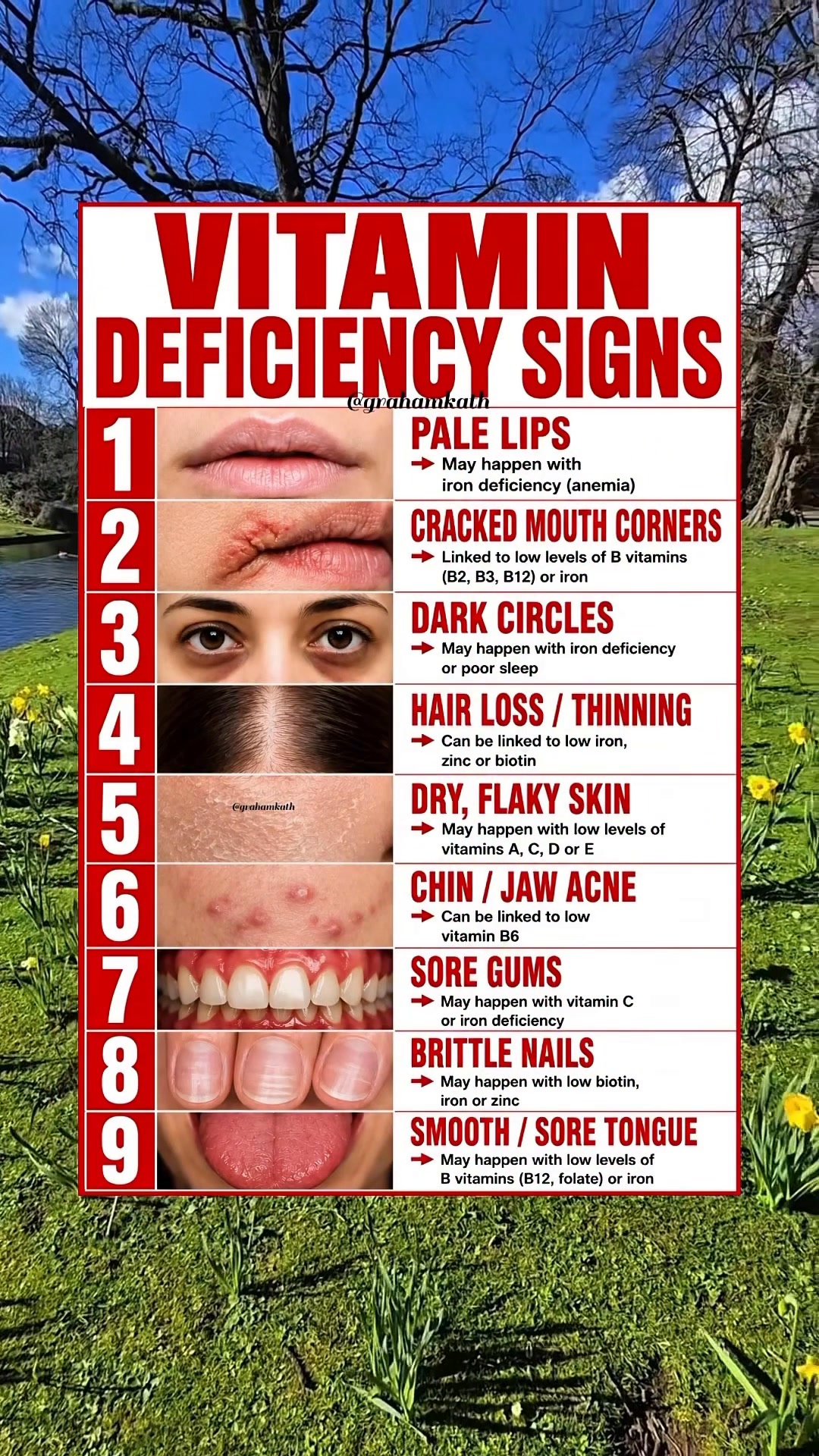 vitamin c deficiency cracked lips Your body can sometimes show warning signs when certain or nutrient levels are low. Pale lips, mouth corners, sore gums, hair thinning, or brittle nails may be worth paying attention تونر توحيد لون البشرة Ct.:1 Patch dihexa benefits wholisticresearch —