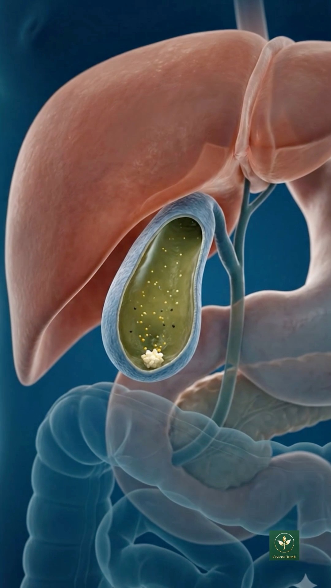 GLP 1 medications can offer weight loss benefits, but they can also affect how your digestive system works. Colorectal Surgeon Dr. Anushka Arumugasaamy explai | Wellstar Cobb Medical Center