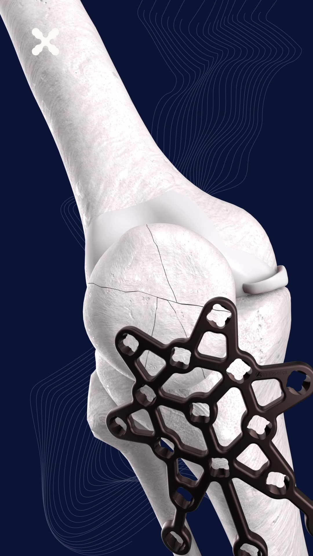 Reinforcing movement, restoring confidence, the science behind Auxein’s ...