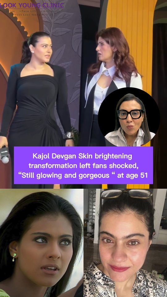 kajol glutathione treatment Devgan’s skin brightening transformation has left fans shook! 🔥 Glowing, radiant & absolutely gorgeous even at 51 – proving age is just a number. 💫, Copyright Disclaimer:, Under section 107 of VITAMIN INJECTIONS - Flourish Size:2oz Glass Dropper Bottle brightening