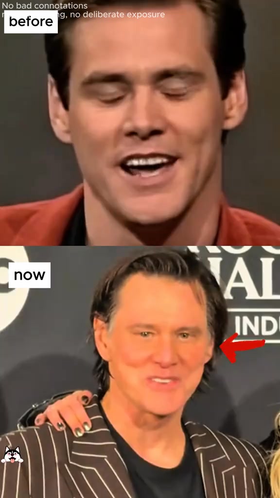 Why does Jim Carrey look like two completely different people? No one ...