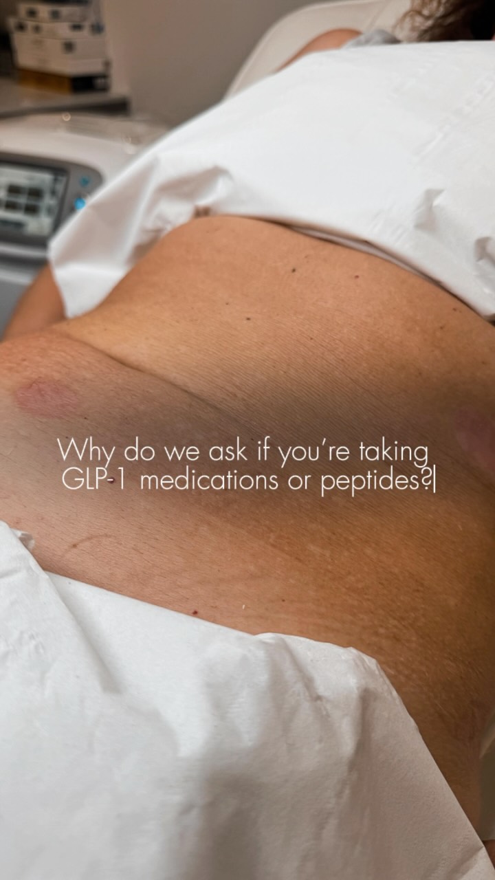 Why do we ask if you’re taking GLP-1 medications or peptides?, Because some medications can affect healing, some carry contraindications and some even change how your skin responds to treatment., We 