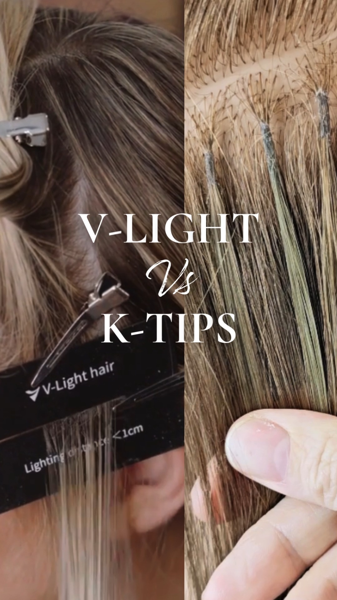 V-Light VS K-Tips.... Which should you choose? The answer is either or ...
