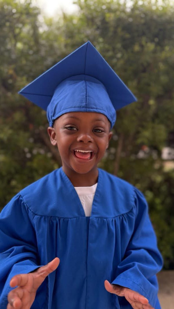 black-down-syndrome-association