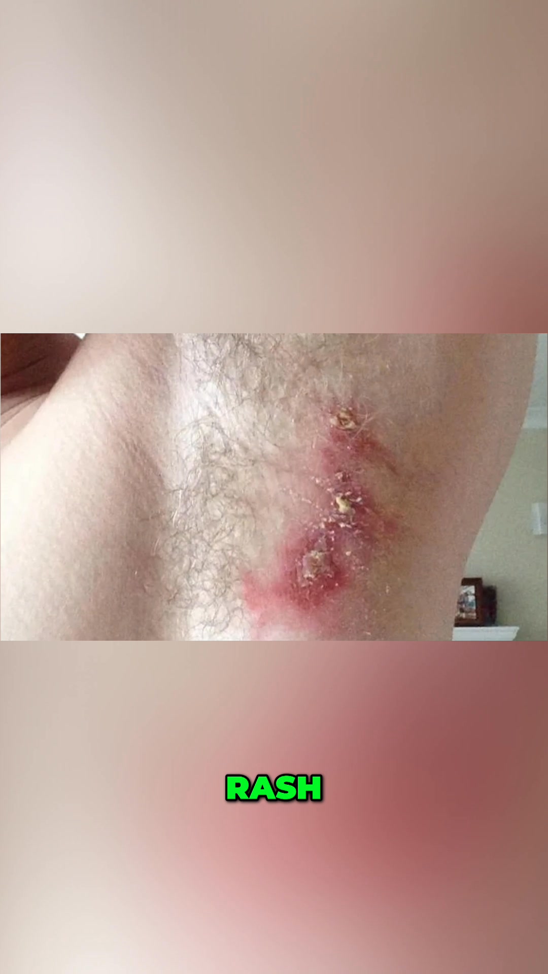 Burning, rashes, swelling? If you've had a reaction to a grooming ...