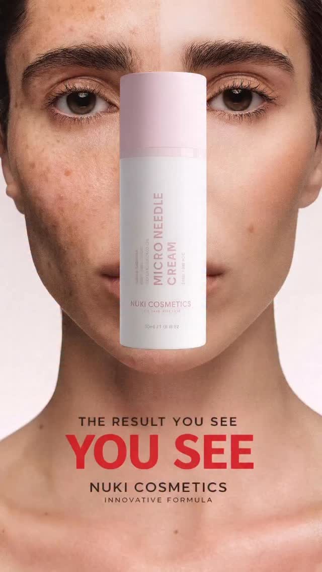 Micro Needle Cream, The treatment your skin has been waiting for., This is not just a cream — it’s a skin transformation in a bottle., Our Micro Needle Cream is powered by advanced spicule technology 
