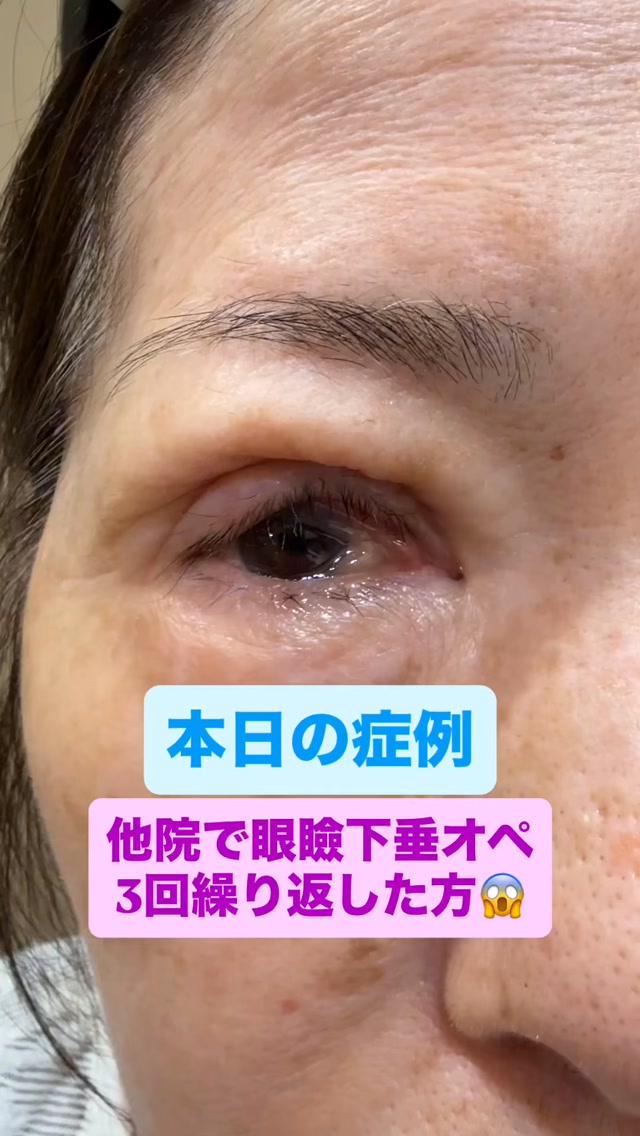 眼形成外科医 鹿嶋友敬 (@gankeisei) • Facebook