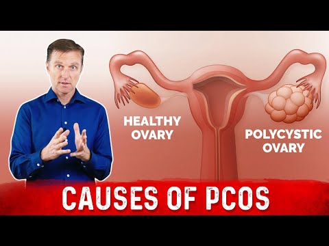 Photo inspiration: Intermittent Fasting For Polycystic Ovary Syndrome Reference: 3 Causes Of Polycystic Ovarian Syndrome Pcos High Androgens